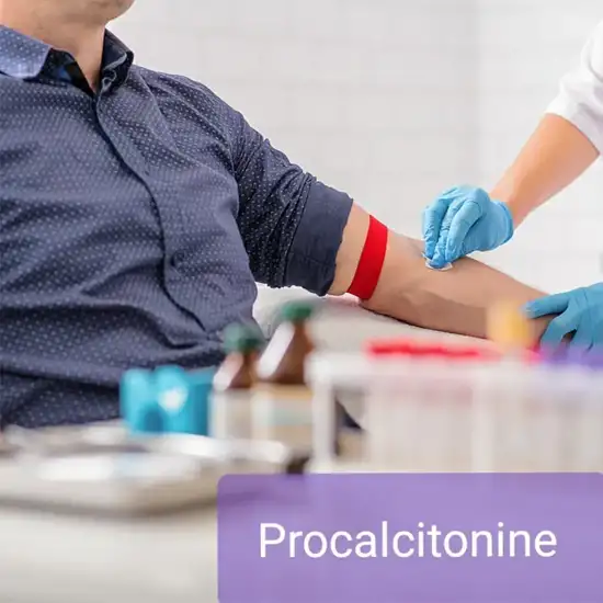 Procalcitonin Test - Unlisted